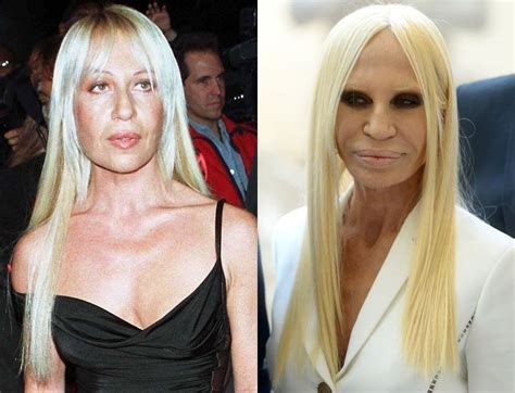 in che anno donatela versace|donatella versace before and after surgery.